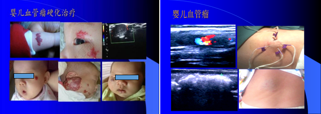 1650271548195308.png image.png