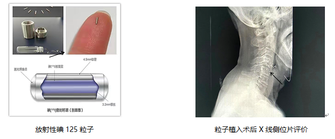 1652251987221221.png image.png